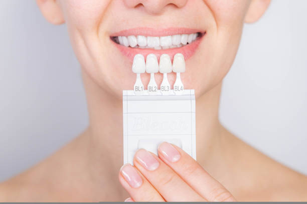 woman comparing a teeth color palette with her normal teeth