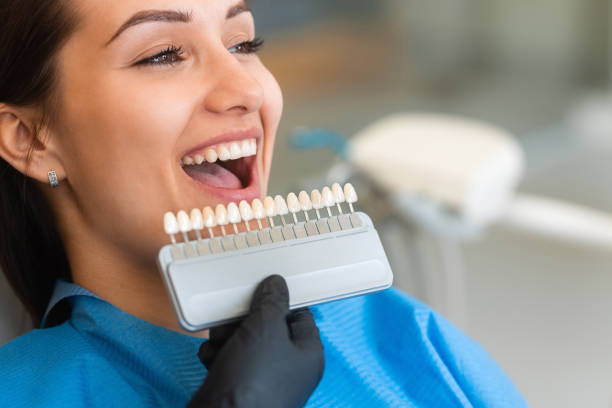 a woman choosing the perfect shade for her tooth replacement
