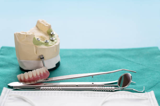 photo of dental implants with dentures and dental tools on a surface