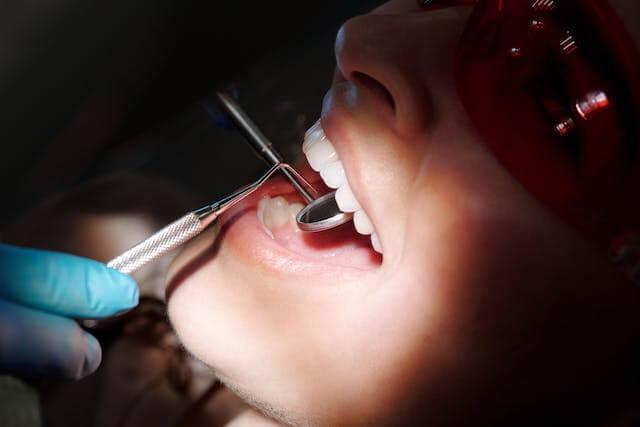 close-up shot of a person's mouth during a dental procedure